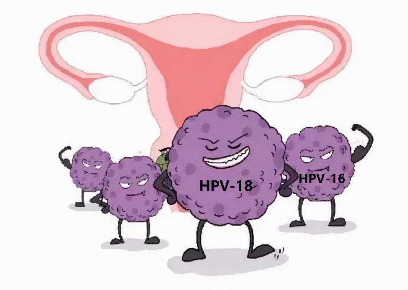 TCT和HPV检测准吗？